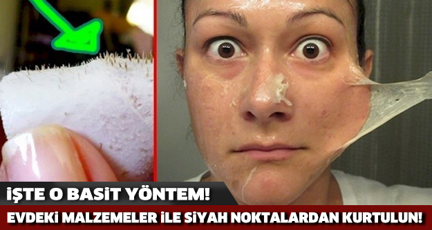 Evdeki Malzemelerle Yüzünüzdeki Siyah Noktalardan Kurtulun..