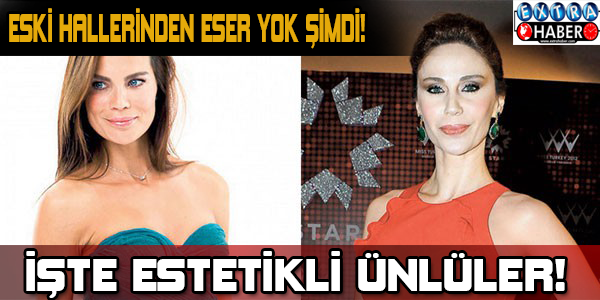 İşte estetikli ünlüler! Eski hallerinden eser yok şimdi...