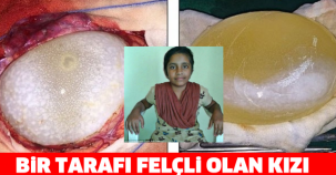 BİR TARAFI FELÇLİ OLAN KIZI MUAYENE EDEN DOKTOR SEBEBİNİ ANLAYINCA ŞOKE OLDULAR...