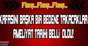 KAFASINI BAŞKA BİR BEDENE TAKACAKLAR..!