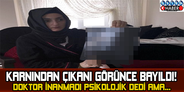 Doktor İnanamadı Psikolojik Dedi Ama... Karnından Çıkanı Görünce Bayıldı!
