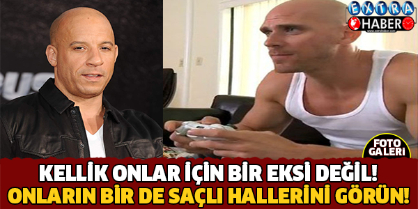 'Saçları Olsa Bu Kadar Çekici Olmazmış' Dediğiniz Ünlülerin Saçlı Halleri