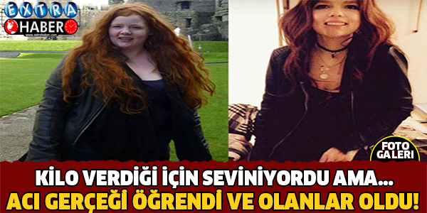 Kilo Verdiği İçin Seviniyordu Ama.. Acı Gerçeği Öğrendi !
