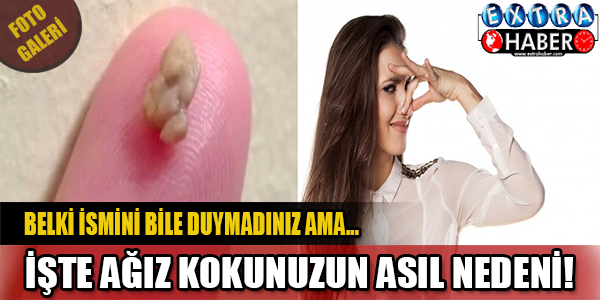 Kimse bilmiyordu ama nedeni buymuş!