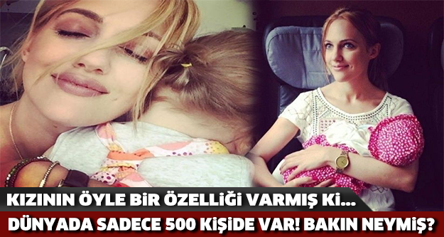 Kızının Öyle Bir Özelliği Varmış ki! Dünyada Sadece 500 Kişide Var!!