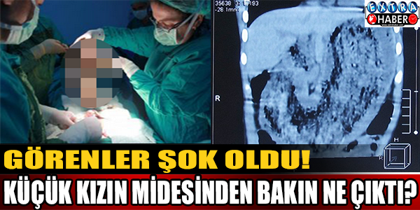 Küçük kızın midesinden öyle bir şey çıktı ki..!