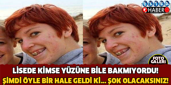 Lisede Kimse Yüzüne Bile Bakmıyordu ! Şimdi Öyle Bir Hale Geldiki.. Şok Olacaksınız !!