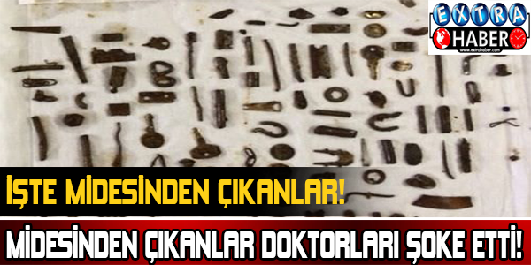 Midesinden çıkanlar doktorları şoke etti!