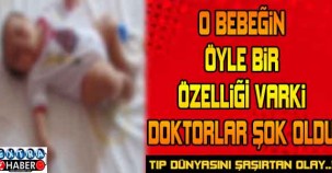 O BEBEĞİN ÖYLE BİR ÖZELLİĞİ VARKİ DOKTORLAR ŞOK OLDU..!