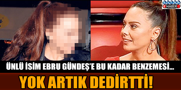 Ona benzemek için botoks mu yaptırdı!