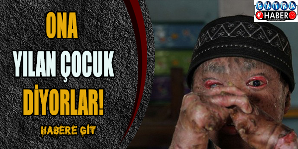 Ona Yılan Çocuk Diyorlar!