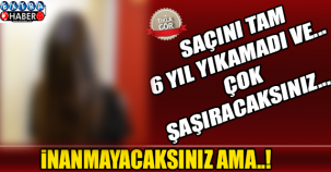 İNANMAYACAKSINIZ AMA TAM 6 YIL SAÇLARINI YIKAMADI...
