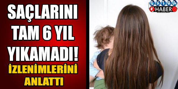 Saçlarını tam 6 yıl yıkamadı! İzlenimlerini anlattı...