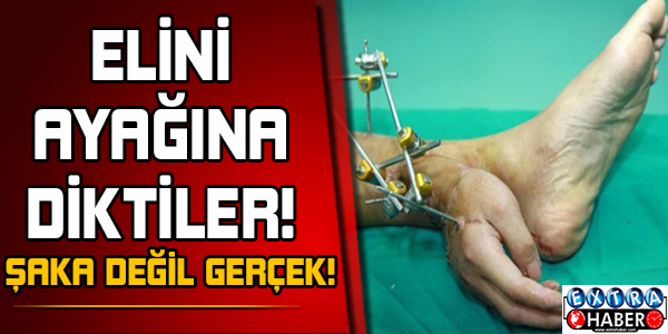 Şaka Değil Gerçek - Elini ayağına diktiler!