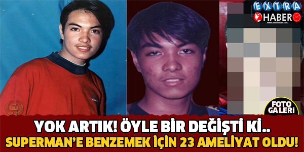 Superman'e Benzemek İçin 23 Kez Ameliyat Oldu! Son Hali Şok Etti..