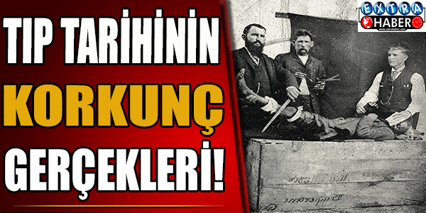 Tıp Tarihinin Korkunç Gerçekleri!