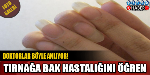 Eğer tırnaklarınız böyleyse...