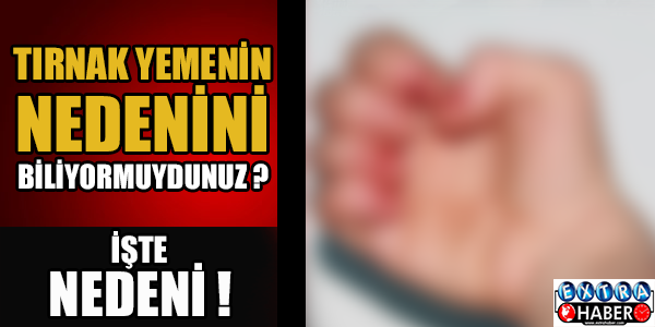 Tırnak yemenin asıl nedeni buymuş!