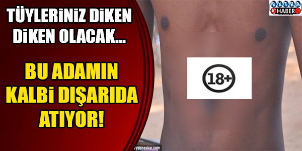 BU ADAMIN KALBİ DIŞARDA ATIYOR!
