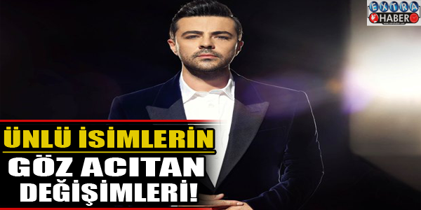Ünlü isimleri göz acıtan değişimleri!
