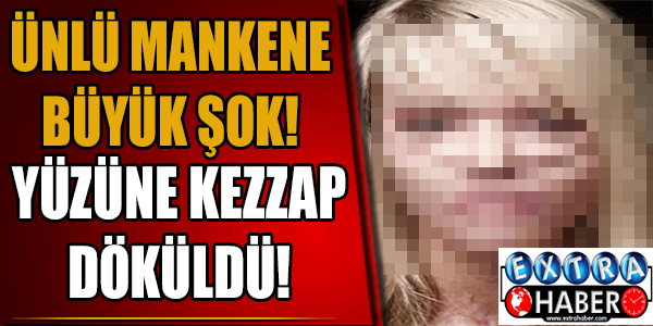 Ünlü mankene büyük şok! Yüzüne kezzap döküldü!
