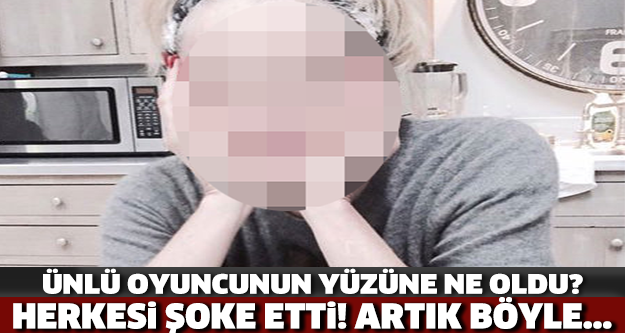 Ünlü oyunucunun yüzüne ne oldu?