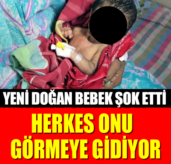 YENİ DOĞAN BEBEK ŞOK ETTİ!! HERKES ONU GÖRMEYE GELİYOR!!