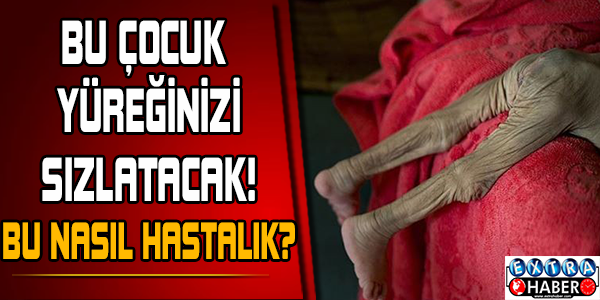 13 ayda sadece 50 gram aldı
