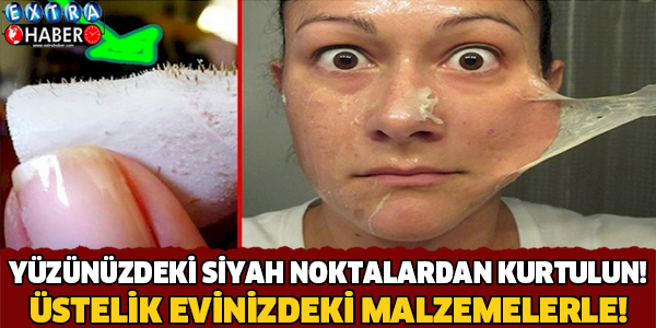 Evdeki Malzemelerle Yüzünüzdeki Siyah Noktalardan Kurtulun..