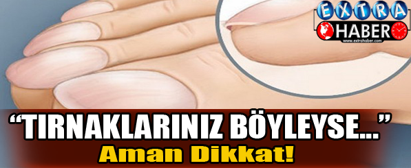 Tırnaklarınız böyleyse aman dikkat!
