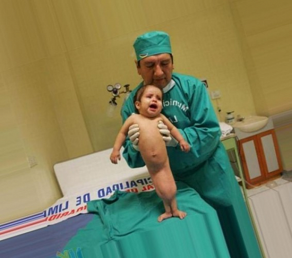 DOKTORLAR GÖZLERİNE İNANAMADI! MİLYONDA BİR GÖRÜLEN RAHATSIZLIK BU YAVRUCAKTA GÖRÜLDÜ! SUBHANALLAH...
