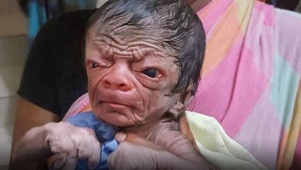 YENİ DOĞAN BEBEK ŞOK ETTİ!! HERKES ONU GÖRMEYE GELİYOR!!