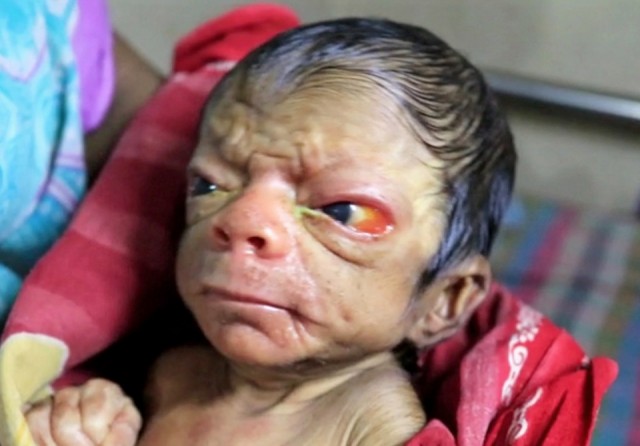 YENİ DOĞAN BEBEK ŞOK ETTİ!! HERKES ONU GÖRMEYE GELİYOR!!