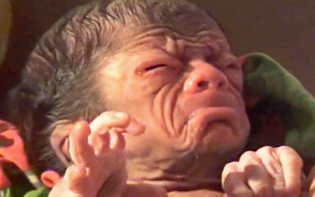 YENİ DOĞAN BEBEK ŞOK ETTİ!! HERKES ONU GÖRMEYE GELİYOR!!
