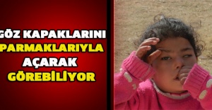 Göz kapaklarını parmaklarıyla açarak görebiliyor