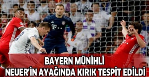 BAYERN MÜNİHLİ NEUER'İN AYAĞINDA KIRIK TESPİT EDİLDİ