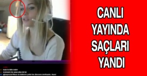 Canlı yayında saçları yandı