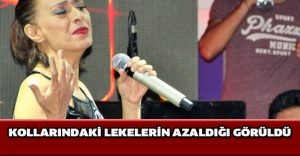 Kollarındaki lekelerin azaldığı görüldü