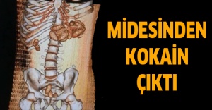 Midesinden kokain çıktı