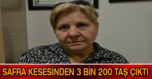 Safra kesesinden 3 bin 200 taş çıktı