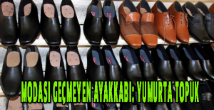 Modası geçmeyen ayakkabı: Yumurta topuk