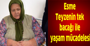 Esme Teyzenin tek bacağı ile yaşam mücadelesi