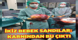 İkiz bebek sandılar: Karnından bu çıktı