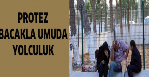 Protez bacakla umuda yolculuk