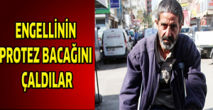 Engellinin protez bacağını çaldılar