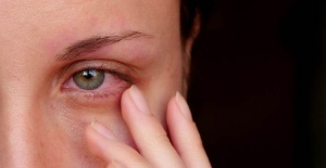 KONJONKTİVİT Mİ CORONAVIRUS MÜ?