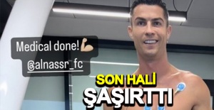Ronaldo’nun bacaklarının son hali futbol severleri şaşırttı