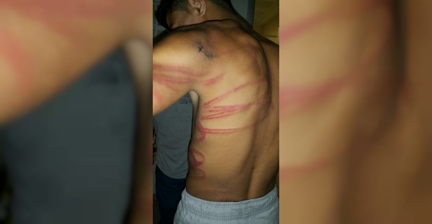 16 Yaşındaki Çocuğa Saatlerce İşkence Yaptılar